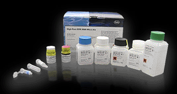 Image: The High Pure FFPET RNA Isolation Kits (Photo courtesy of Roche).